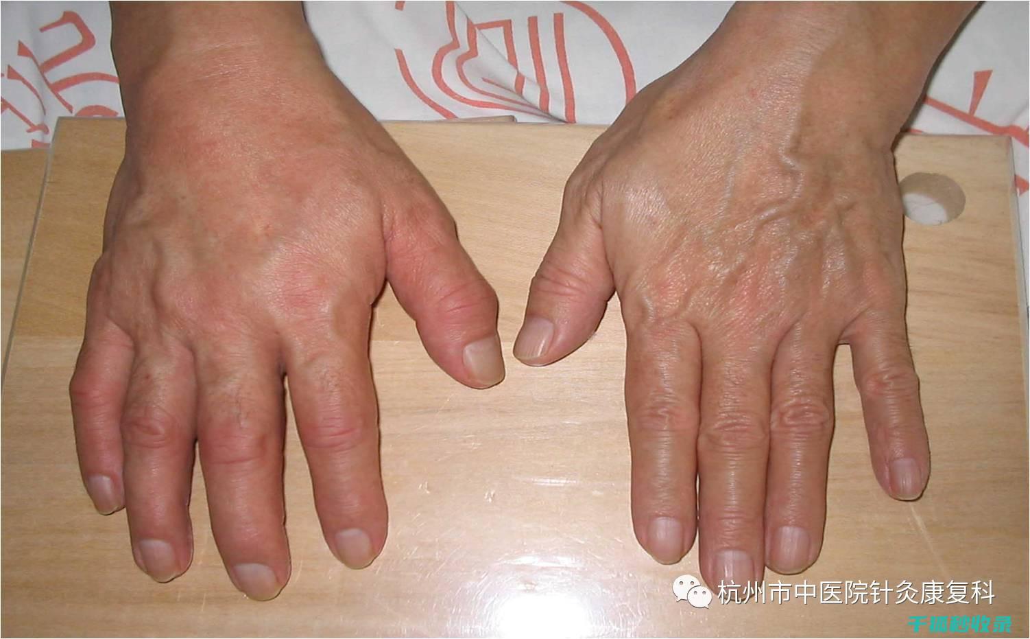 手上有异味？这些去除异味的小窍门太实用 (手上有异味怎么去除)
